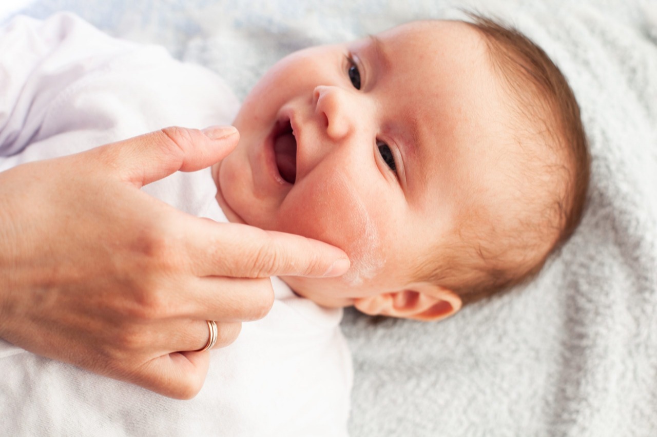 ما أسباب ظهور بقع بيضاء في الوجه عند الأطفال الرضع؟