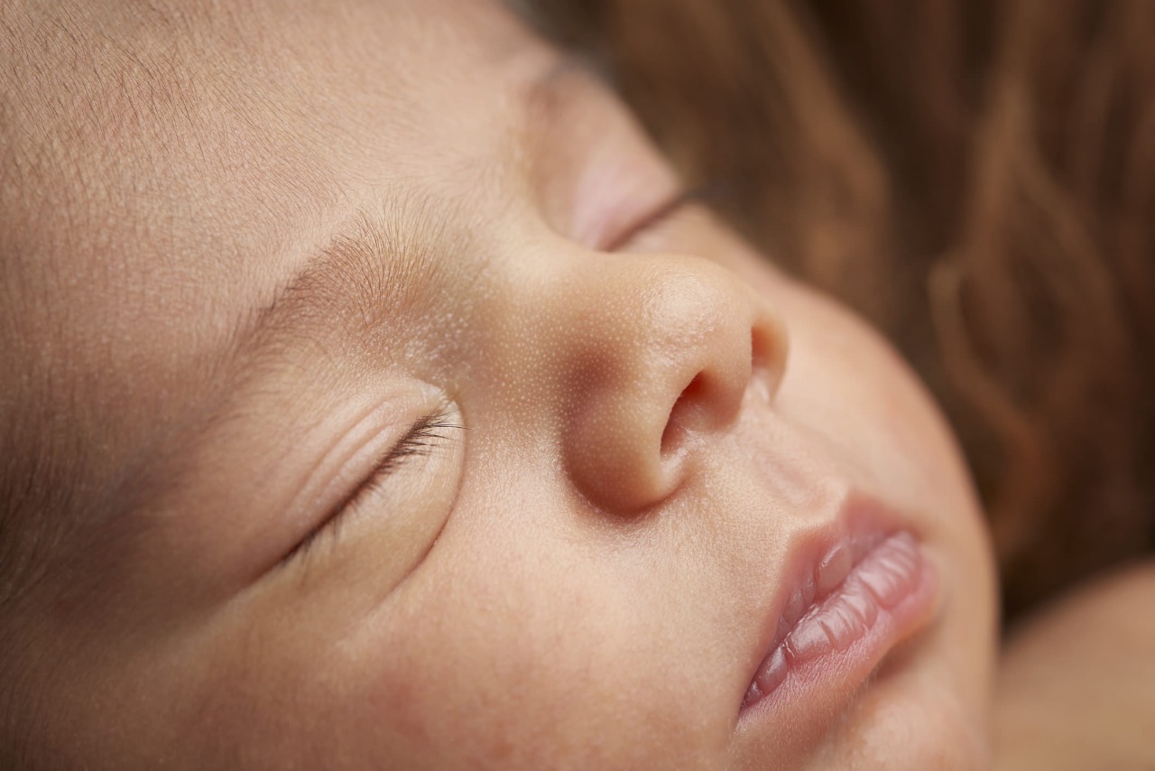 ما أسباب تشقق الشفاه عند الأطفال الرضع؟