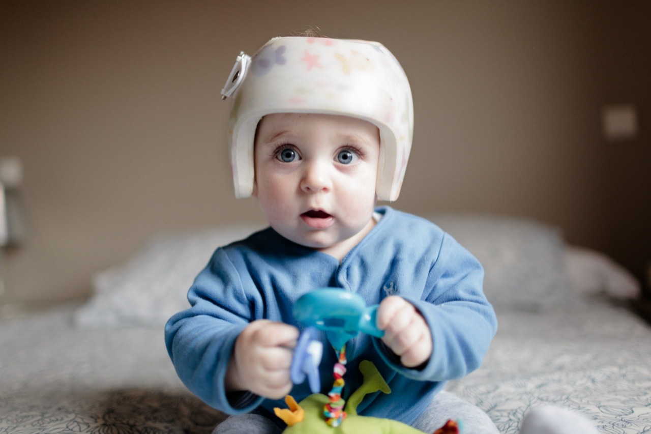 هل استخدام خوذة تعديل رأس الطفل آمن؟