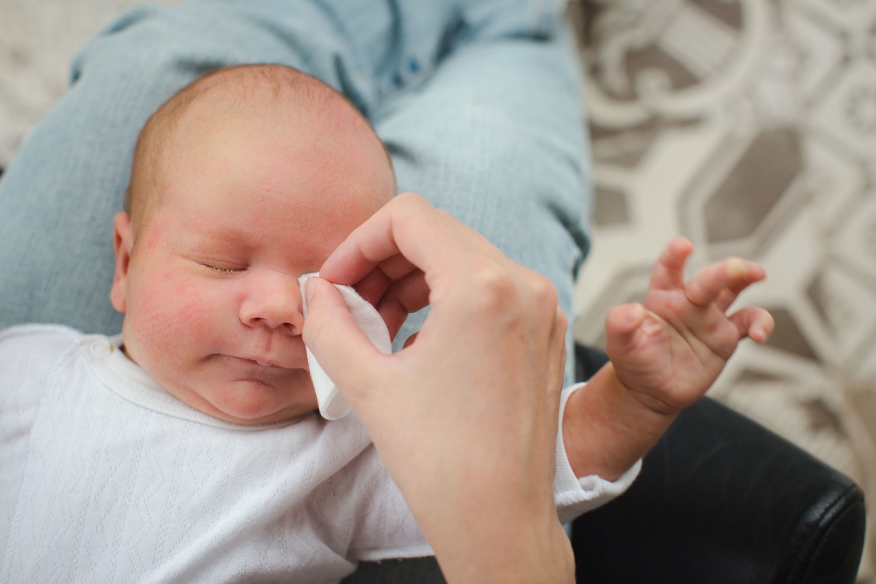 ما أسباب التهاب الملتحمة عند الرضع؟